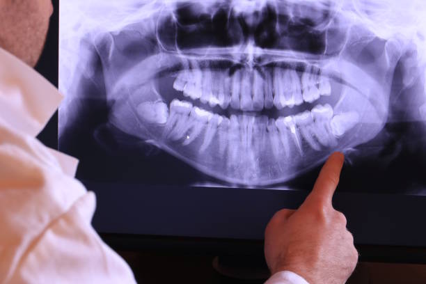 Best Emergency Dentist for Knocked-Out Tooth in Xtonia, PA